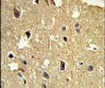 beta Tubulin Antibody in Immunohistochemistry (IHC)