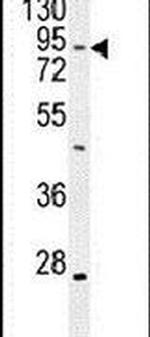 TBC1D14 Antibody in Western Blot (WB)