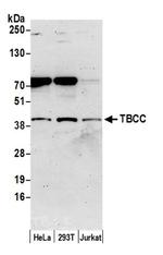TBCC Polyclonal Antibody