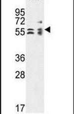 TBCE Antibody in Western Blot (WB)