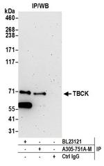 TBCK Polyclonal Antibody