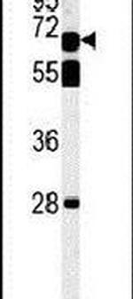 Prosapip2 Antibody in Western Blot (WB)