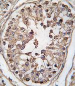 TBK1 Antibody in Immunohistochemistry (IHC)
