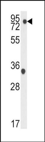 TBK1 Antibody in Western Blot (WB)