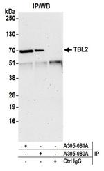 TBL2 Antibody in Western Blot (WB)