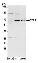 TBL2 Antibody in Western Blot (WB)