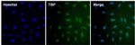 TBP Monoclonal Antibody (1TBP18)