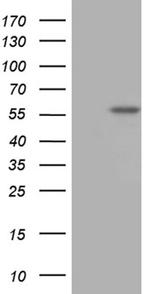 TBX20 Antibody in Western Blot (WB)