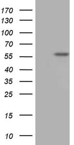 TBX20 Antibody in Western Blot (WB)