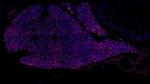 TBX3 Polyclonal Antibody