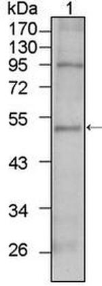 TBX5 Monoclonal Antibody (7B11)