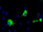 TBXAS Antibody in Immunocytochemistry (ICC/IF)
