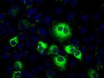 TBXAS Antibody in Immunocytochemistry (ICC/IF)