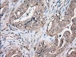 TBXAS Antibody in Immunohistochemistry (Paraffin) (IHC (P))