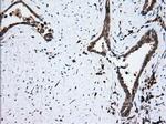 TBXAS Antibody in Immunohistochemistry (Paraffin) (IHC (P))