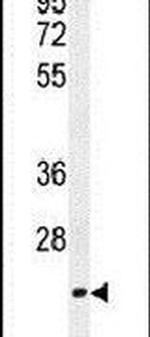 TCEAL3 Antibody in Western Blot (WB)