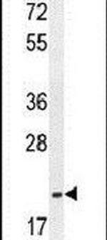 TCEAL3 Antibody in Western Blot (WB)