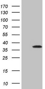 TCEAL1 Antibody in Western Blot (WB)