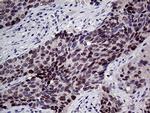 TCF12 Antibody in Immunohistochemistry (Paraffin) (IHC (P))