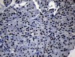 TCF12 Antibody in Immunohistochemistry (Paraffin) (IHC (P))