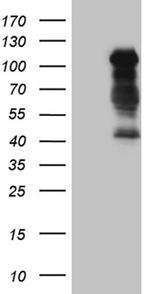 TCF12 Antibody in Western Blot (WB)