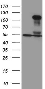 TCF12 Antibody in Western Blot (WB)