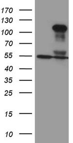 TCF12 Antibody in Western Blot (WB)