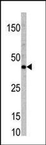 TCF7 Antibody in Western Blot (WB)