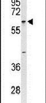 TCHP Antibody in Western Blot (WB)