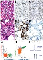 TCR V beta F1 Antibody in Immunohistochemistry (IHC)