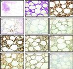 TCR V beta F1 Antibody in Immunohistochemistry (IHC)