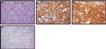 TCR V beta F1 Antibody in Immunohistochemistry (IHC)