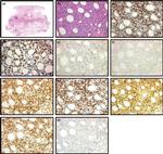 TCR V beta F1 Antibody in Immunohistochemistry (IHC)