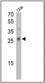 TCR V gamma 9 Antibody in Western Blot (WB)