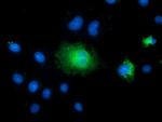 TCTN2 Antibody in Immunocytochemistry (ICC/IF)