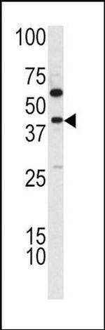 TDG Antibody in Western Blot (WB)