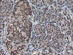 TDO2 Antibody in Immunohistochemistry (Paraffin) (IHC (P))