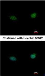 TDP1 Antibody in Immunocytochemistry (ICC/IF)
