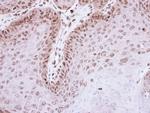 TDP1 Antibody in Immunohistochemistry (IHC)