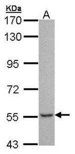TDP1 Antibody in Western Blot (WB)