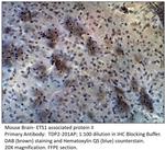 ETS1 Associated protein II Polyclonal Antibody