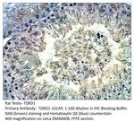 TDRD1 Polyclonal Antibody