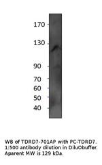 TDRD7 Antibody in Western Blot (WB)