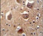 TDRD7 Antibody in Immunohistochemistry (IHC)