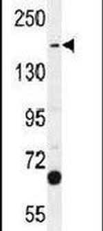 TDRD7 Antibody in Western Blot (WB)