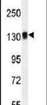 TDRD7 Antibody in Western Blot (WB)