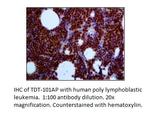TdT Polyclonal Antibody