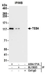 TEB4 Antibody in Western Blot (WB)
