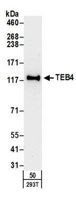 TEB4 Antibody in Western Blot (WB)