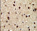 TECPR1 Antibody in Immunohistochemistry (IHC)